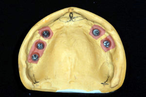 Funktionsdiagnostik