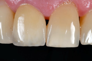Keramische Systeme